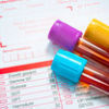 アトピーの血液検査でigeを調べるわけ｜アレルギー体質の数値はいくつ？